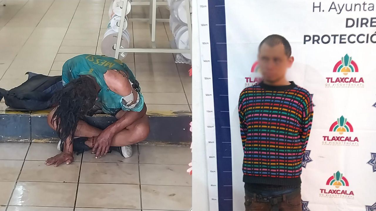 Atienden elementos de la Dirección de Seguridad Municipal de Tlaxcala incidente donde hombre en situación vulnerable fue atacado con fuego